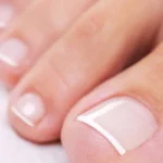 Unhas dos pés bem cuidadas e saudáveis